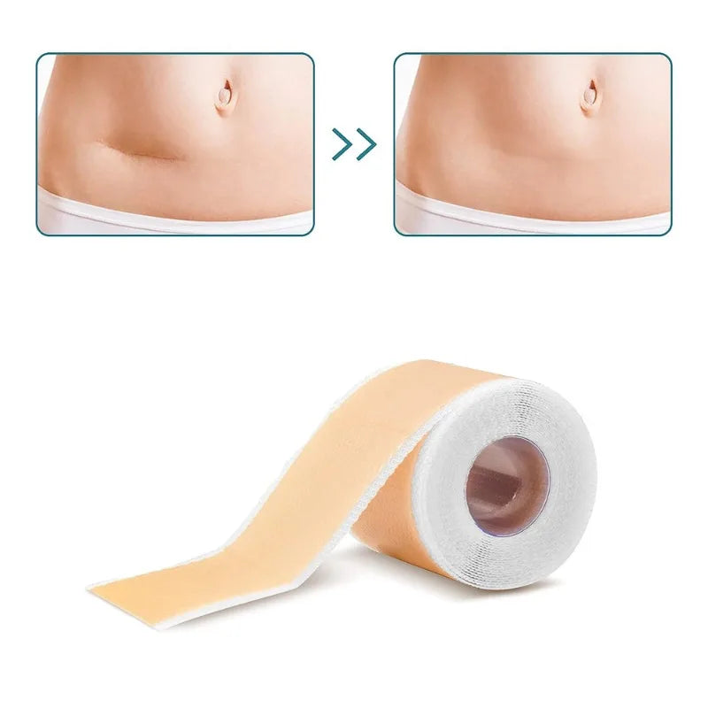 Viarelle SilkMend Scar Tape